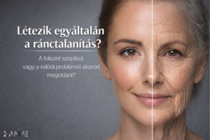 létezik valódi ránctalanítás zanne.hu